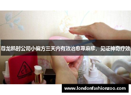 尊龙凯时公司小偏方三天内有效治愈荨麻疹，见证神奇疗效